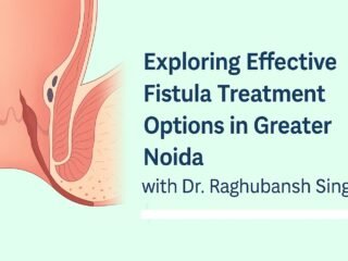 Fistula Treatment in Greater Noida