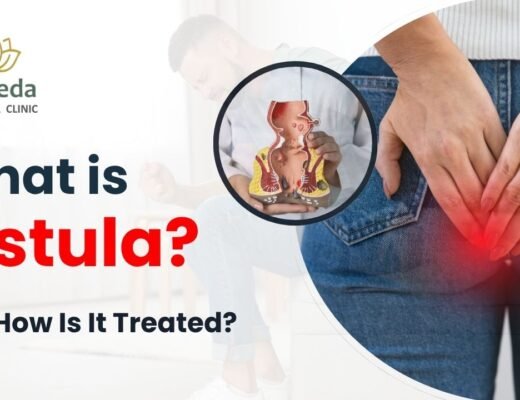 fistula doctor in Delhi NCR