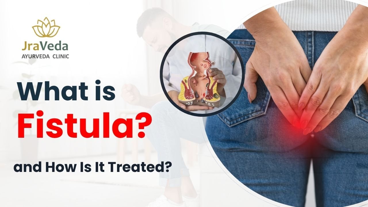 fistula doctor in Delhi NCR