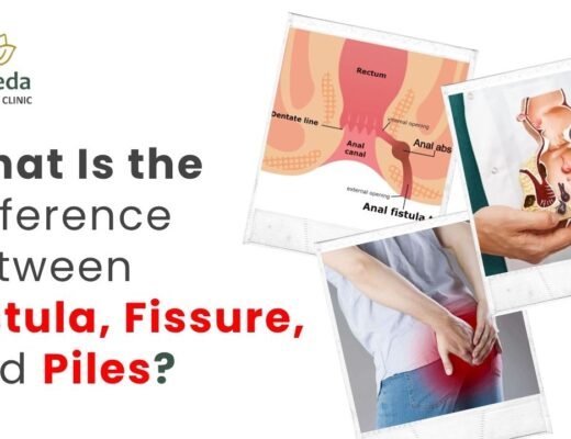Best Fistula doctor in Delhi NCR