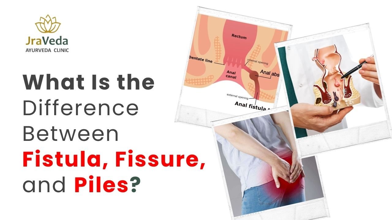 Best Fistula doctor in Delhi NCR